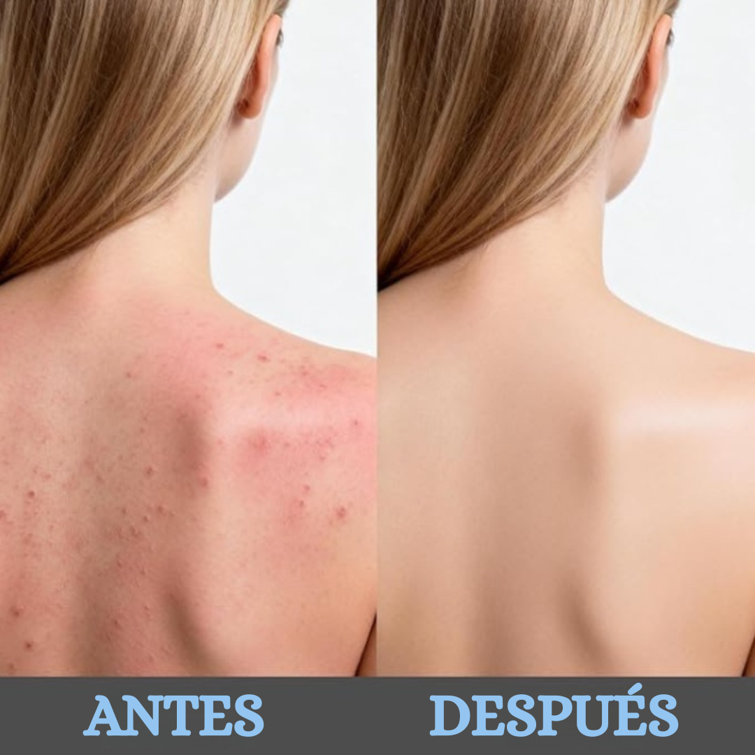 Toalla Exfoliante Antibacterial Dermaly™