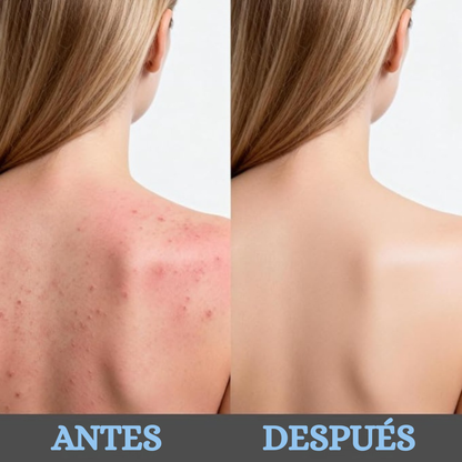 Toalla Exfoliante Antibacterial Dermaly™